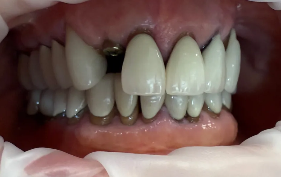Smile Gallery