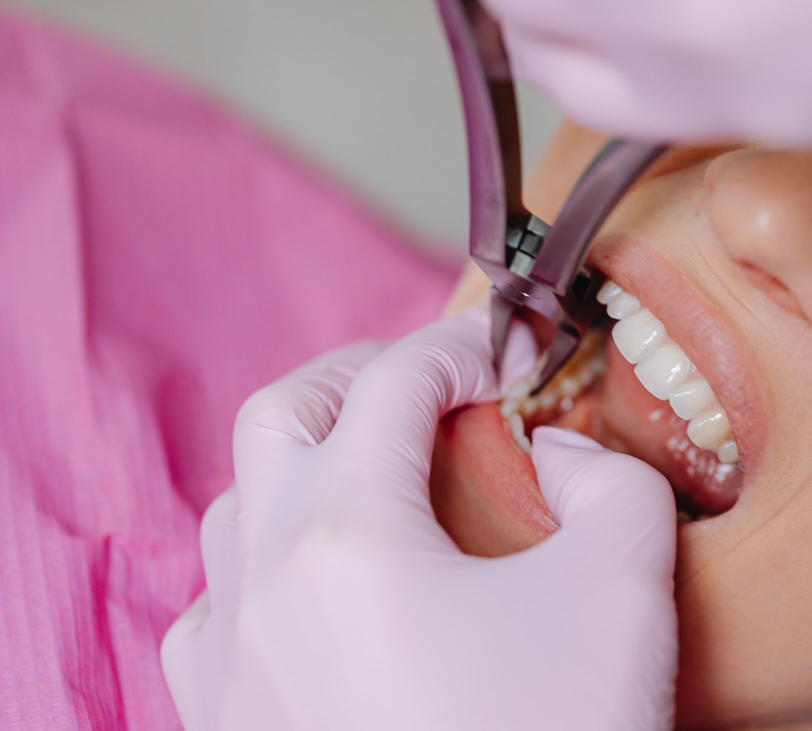 Recovery: What To Expect After Exposure Surgery