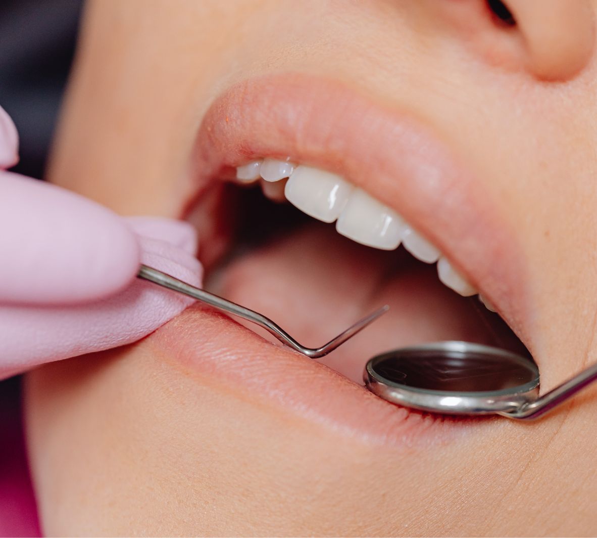 a patient having root planing and scaling