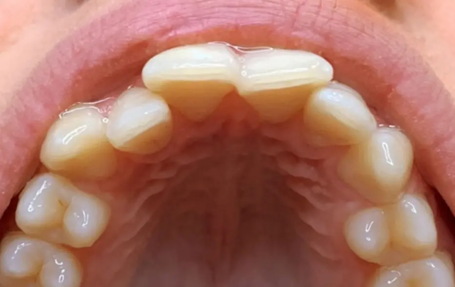Smile Gallery