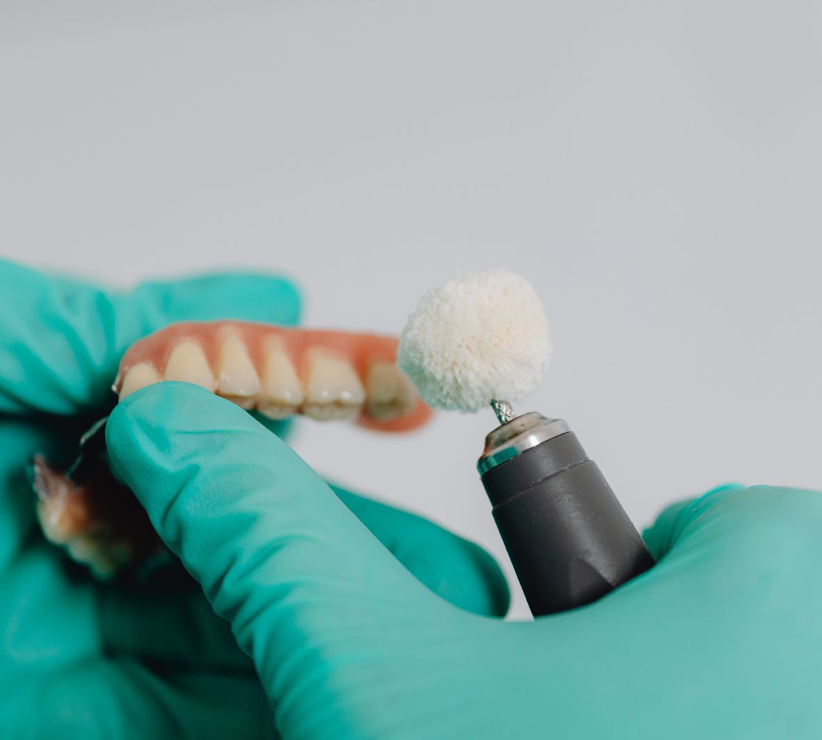 Overdentures — Supported by Implants or Natural Roots