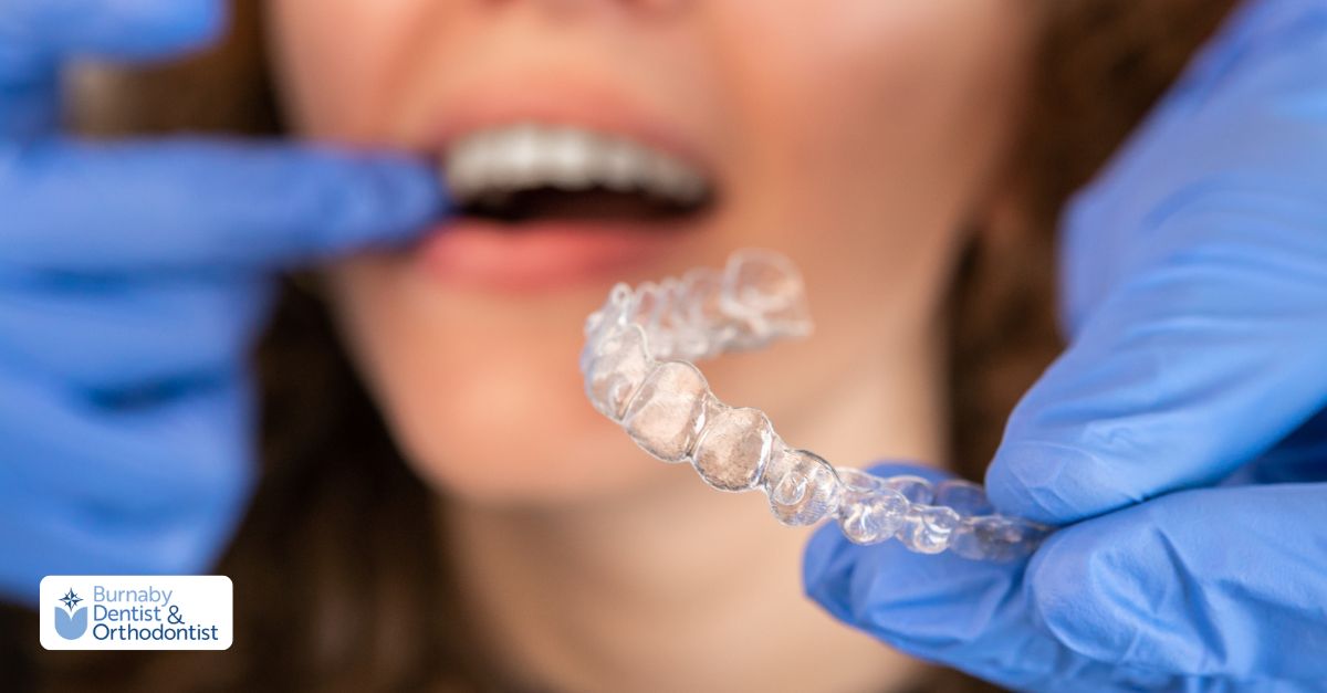 A woman placing her teeth into an Invisalign aligner, showcasing the process of using clear braces for orthodontic care.