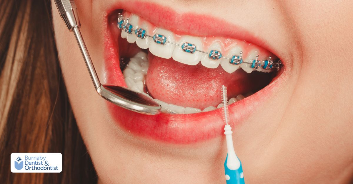 A woman receives a dental treatments from a dentist, highlighting orthodontic care in progress.