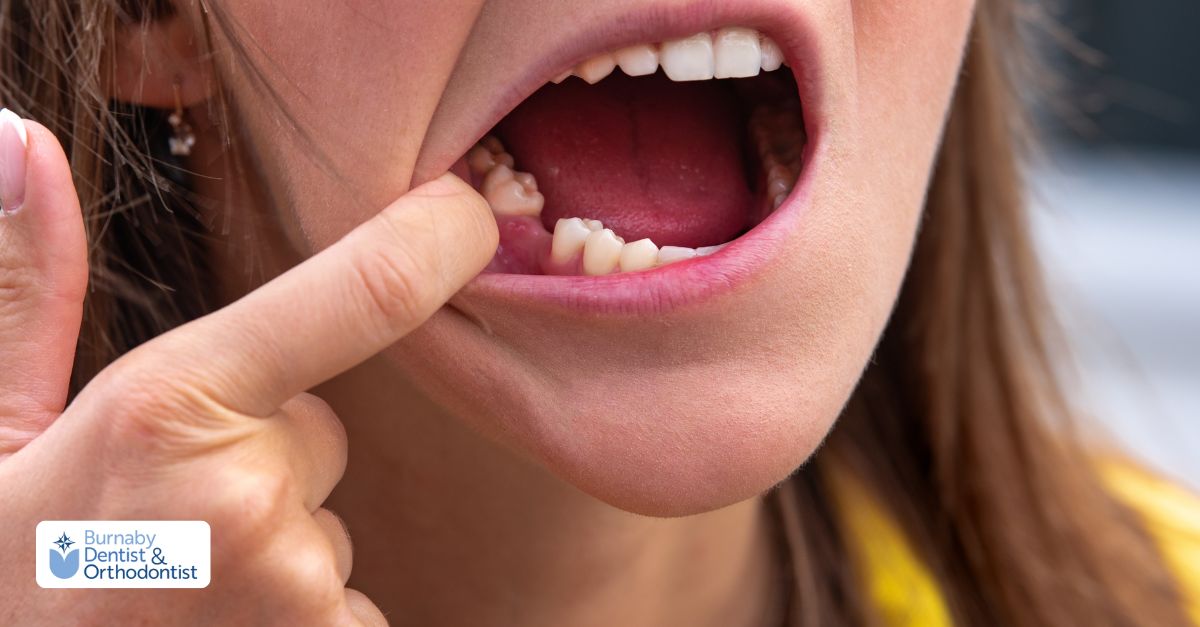 A woman is holding her teeth with her fingers, symbolizing the healing process following a tooth extraction.