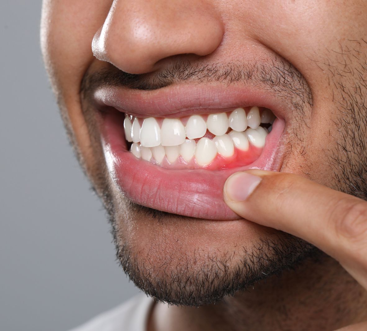 Periodontics (Gum Health)