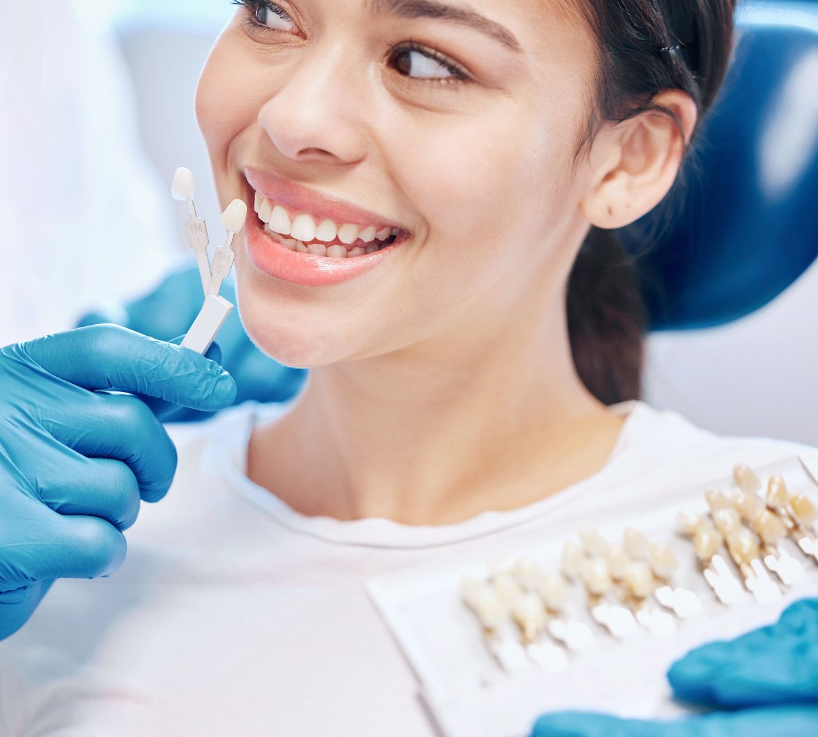 Porcelain Veneers in Burnaby