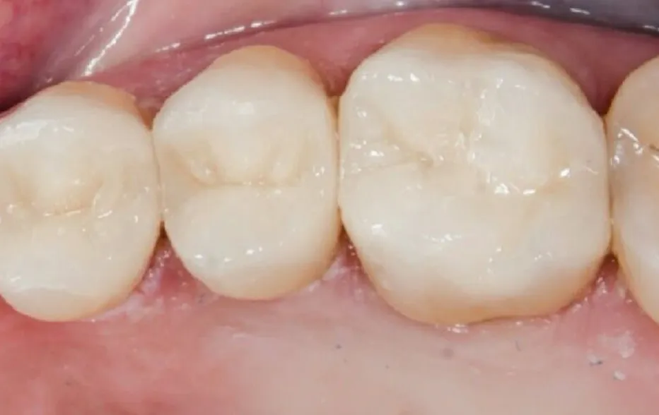 Smile Gallery