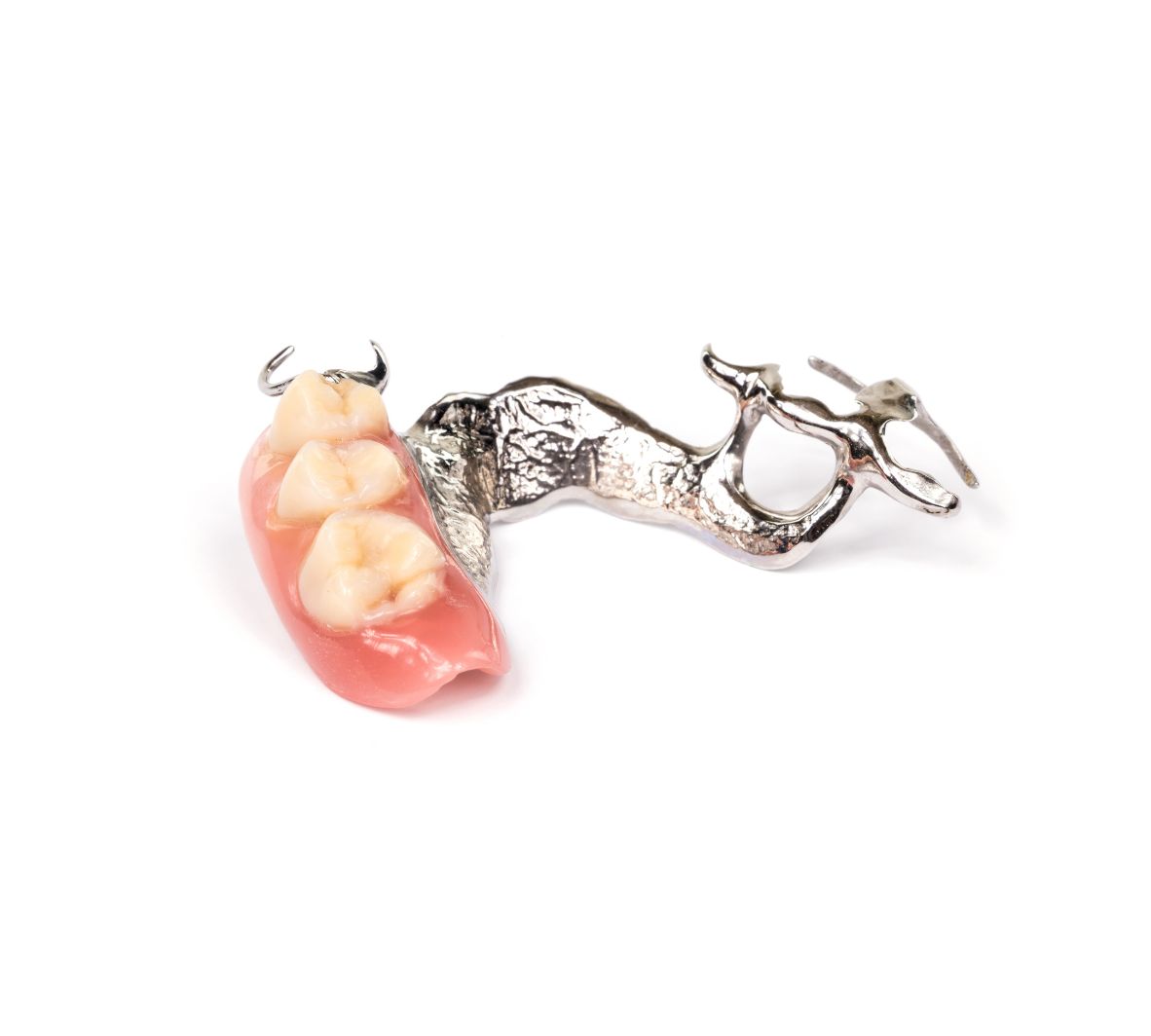 Immediate Dentures — Dentures Placed at the Time of Extractions