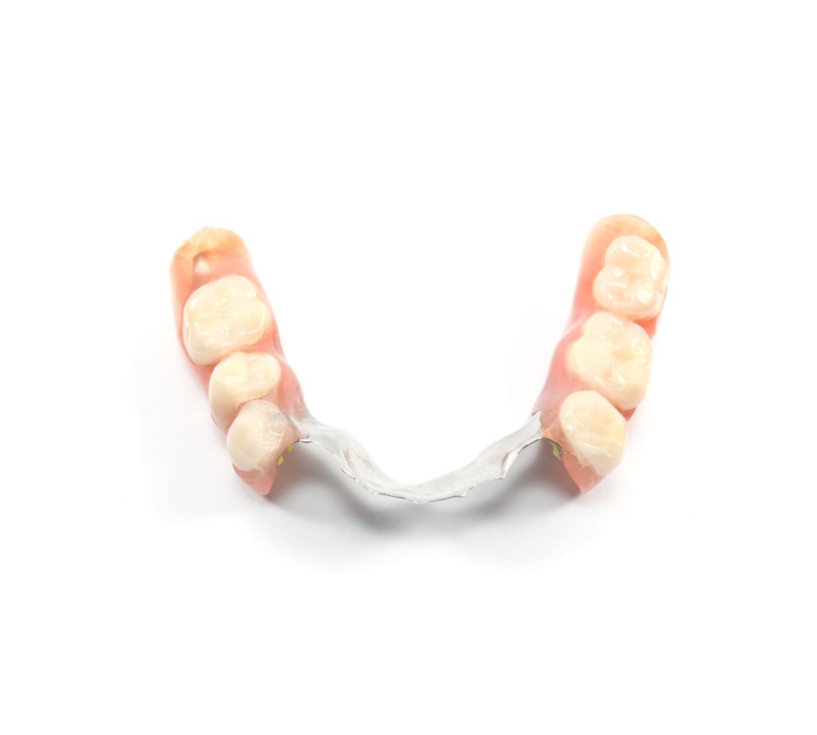 Partial Dentures — When Some Natural Teeth Remain