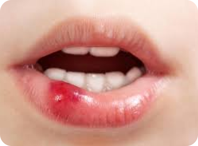 Help Me With Tooth Pain or an Emergency