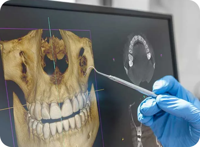 Help Me Fix Missing or Broken Teeth Help Me Fix Missing or Broken Teeth
