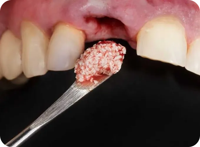 Help Me Fix Missing or Broken Teeth Help Me Fix Missing or Broken Teeth