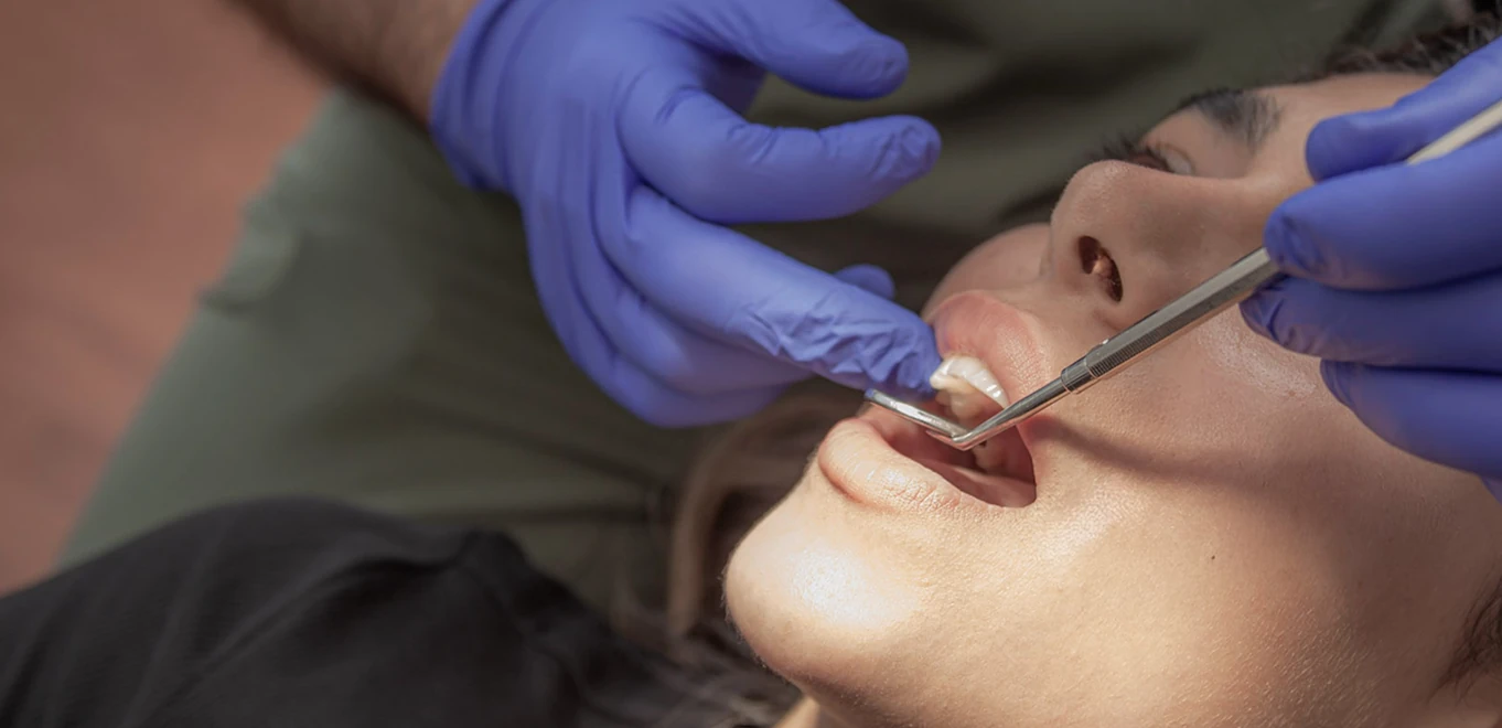 When You Need a Surgical Extraction in Burnaby
