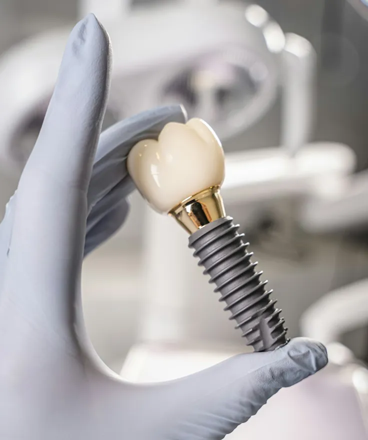 Implant-Supported Restorations