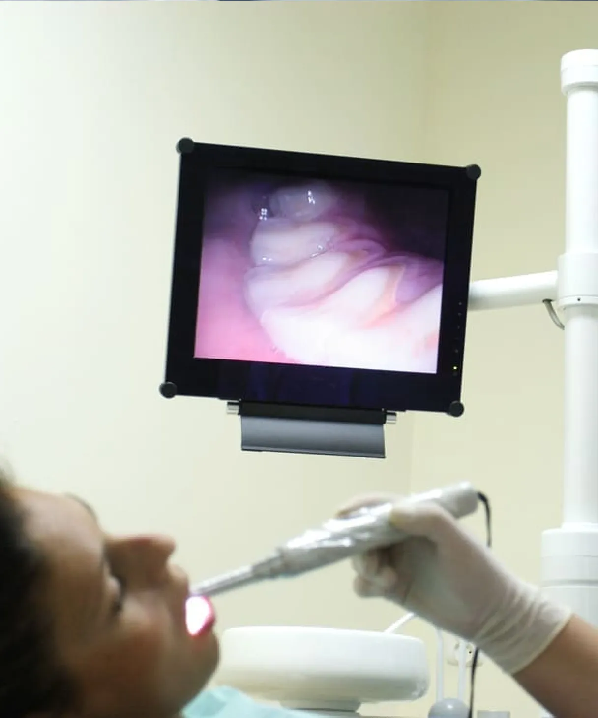 Intraoral Camera Intraoral Camera