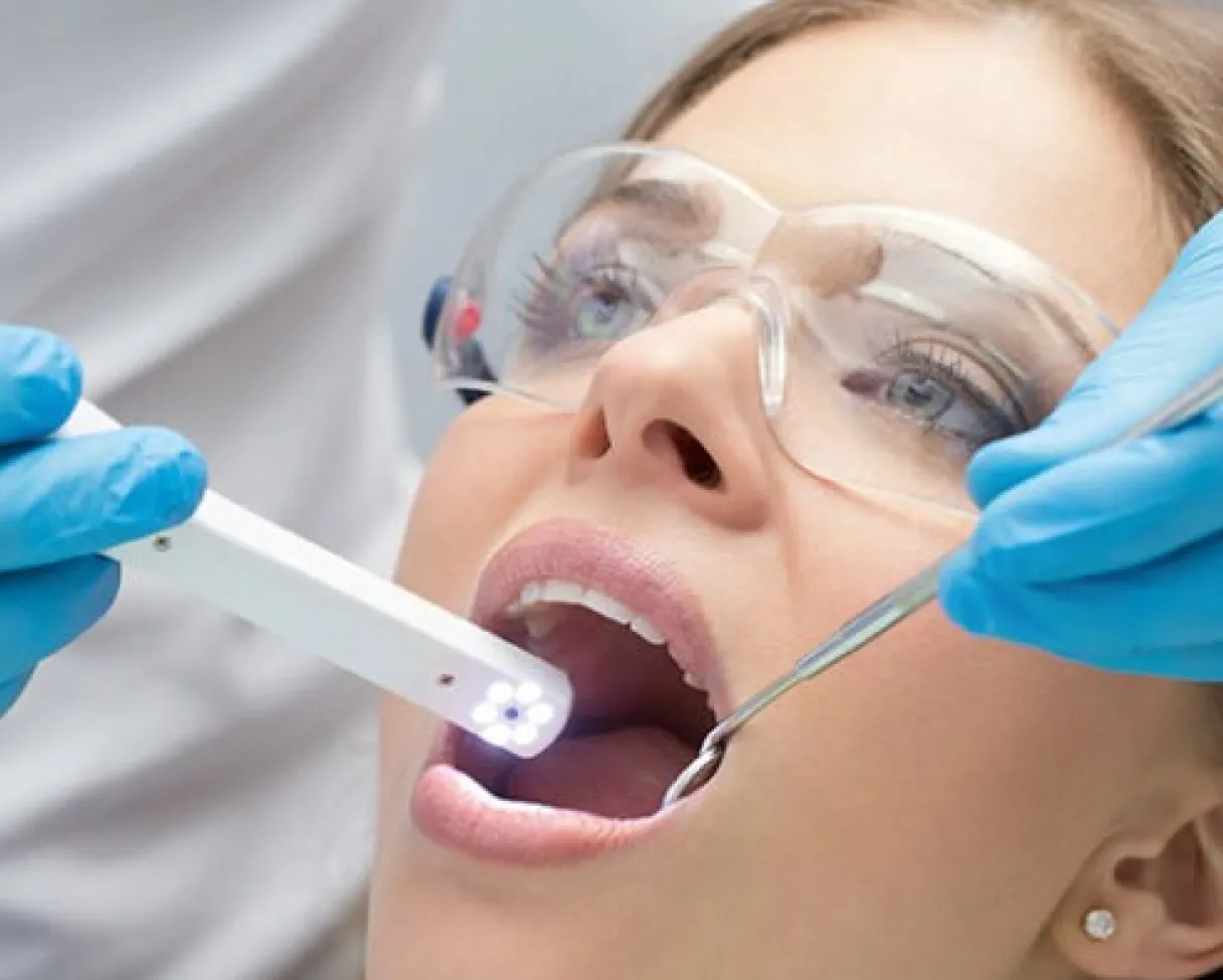 Intraoral Camera Intraoral Camera