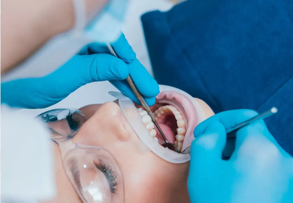 Electrosurgery (Bovie) Electrosurgery (Bovie)