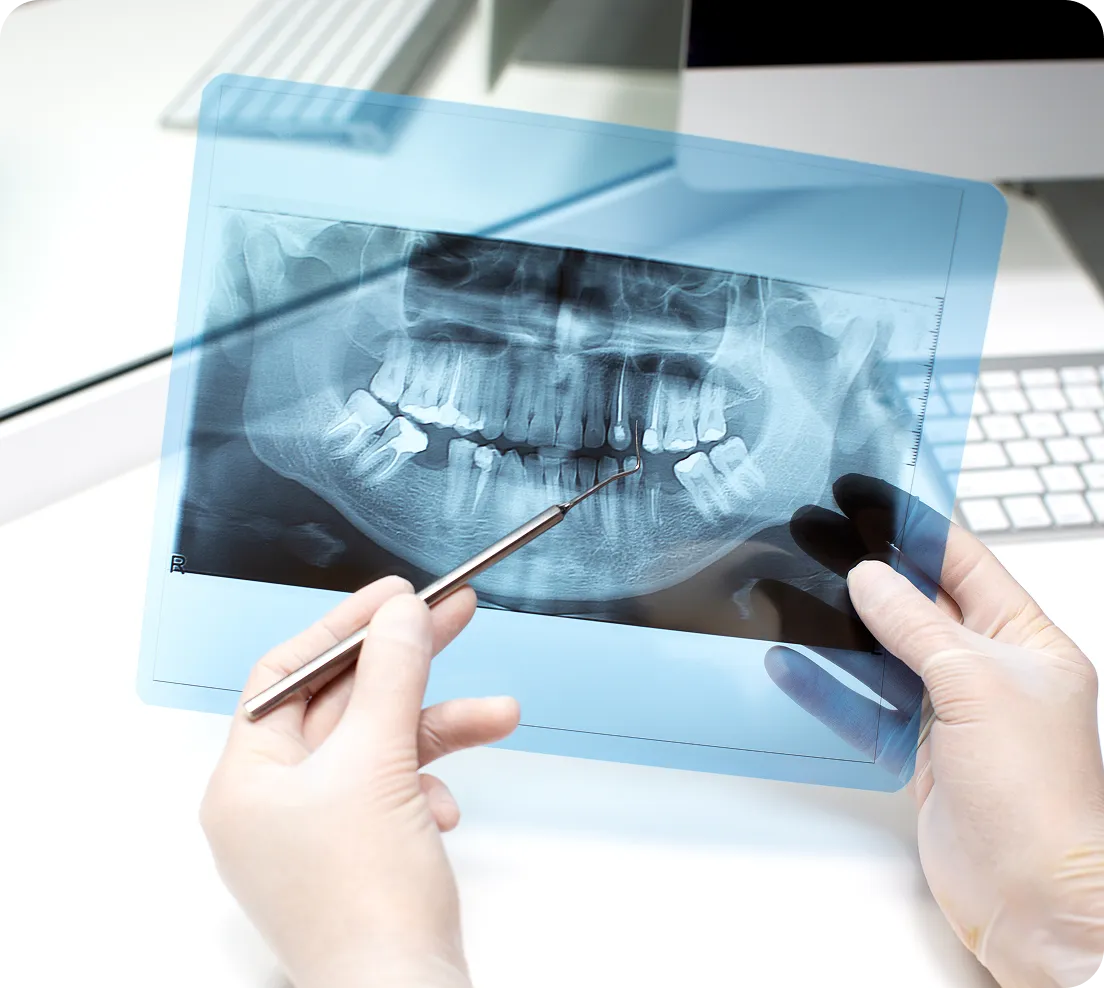 CBCT (3D Scans) in Burnaby
