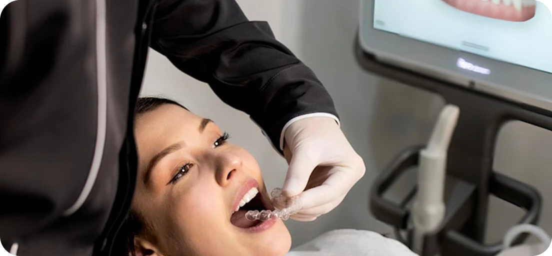 dentist trying clear braces for patient.