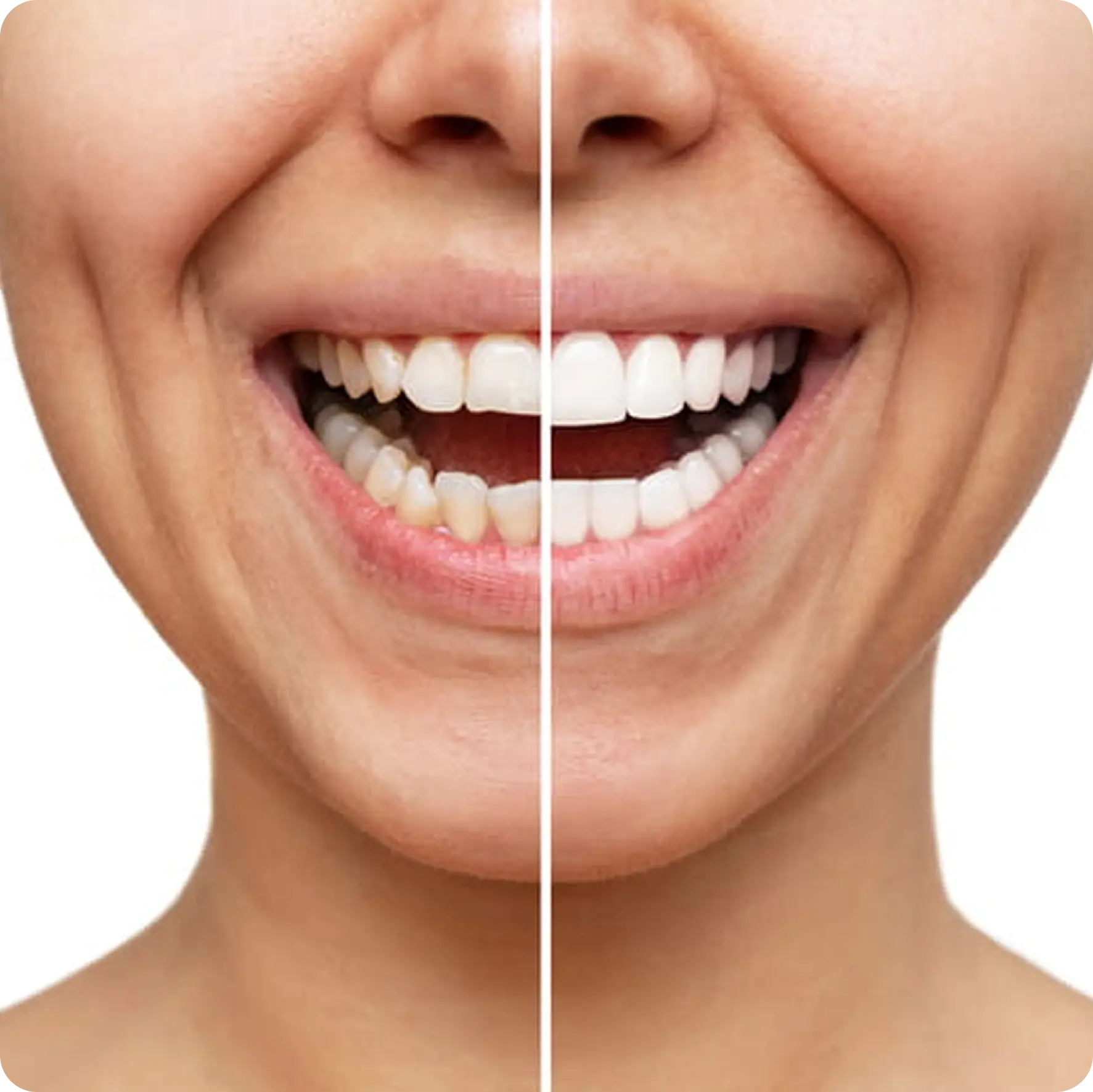 Smile Gallery