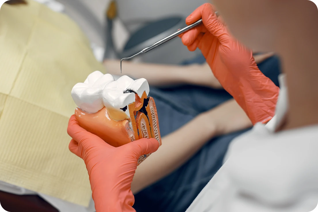 Gloved dentist holding a tooth model to demonstrate dental treatment.