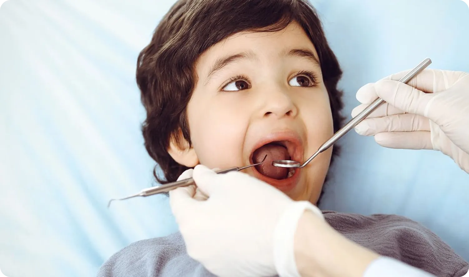 Pediatric Dentistry in Burnaby