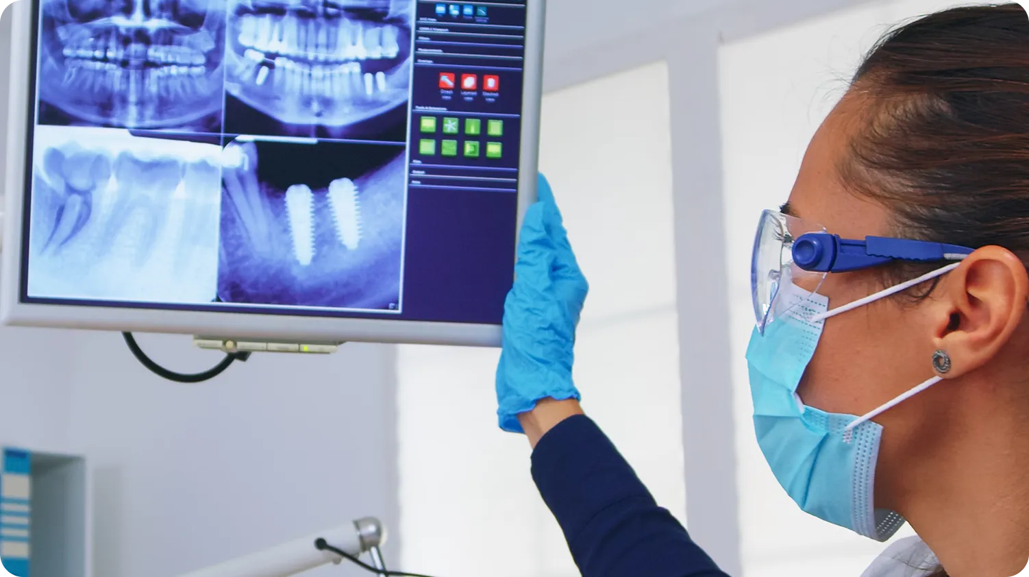 All-on-6 Implant in Burnaby