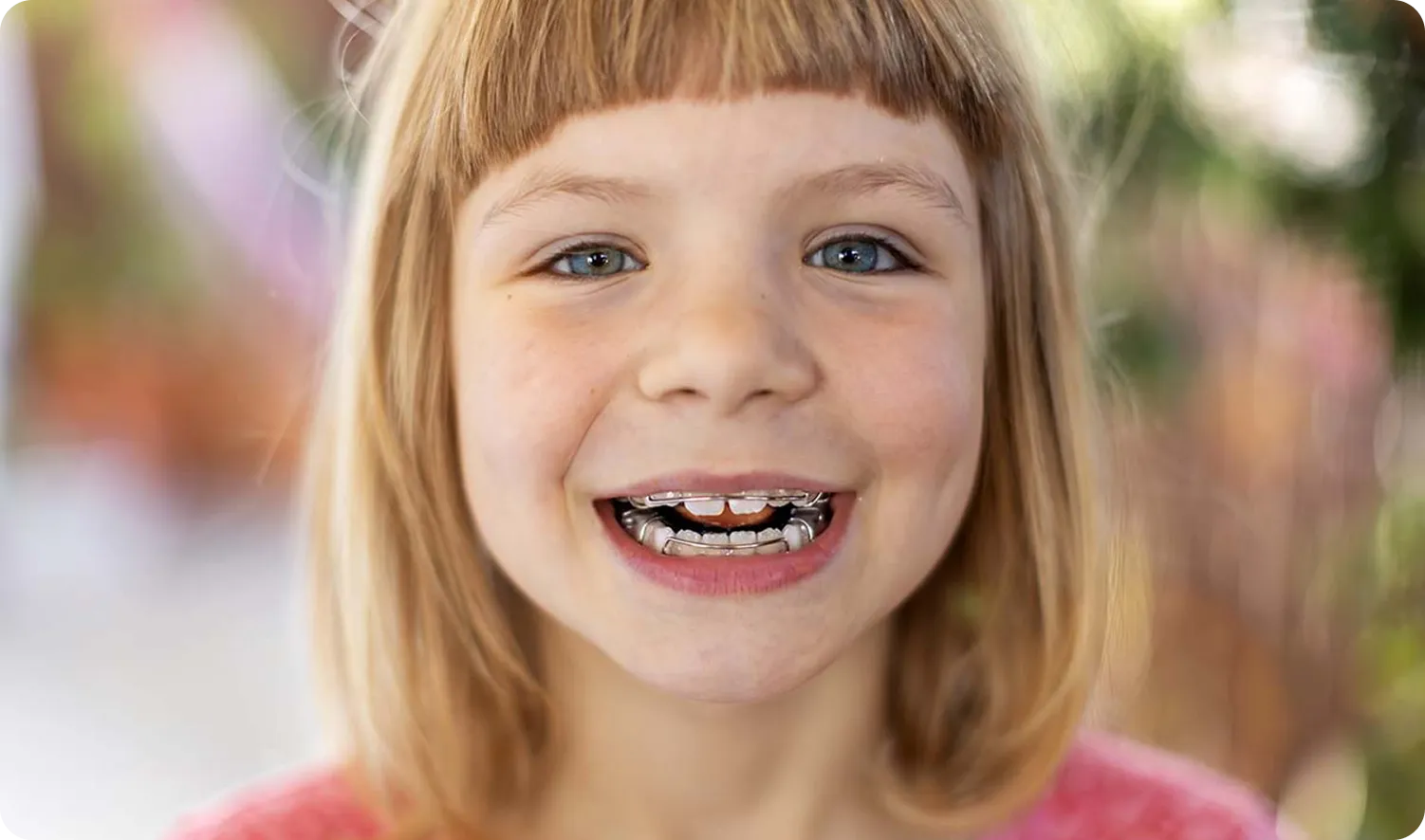 Pediatric Dentistry in Burnaby