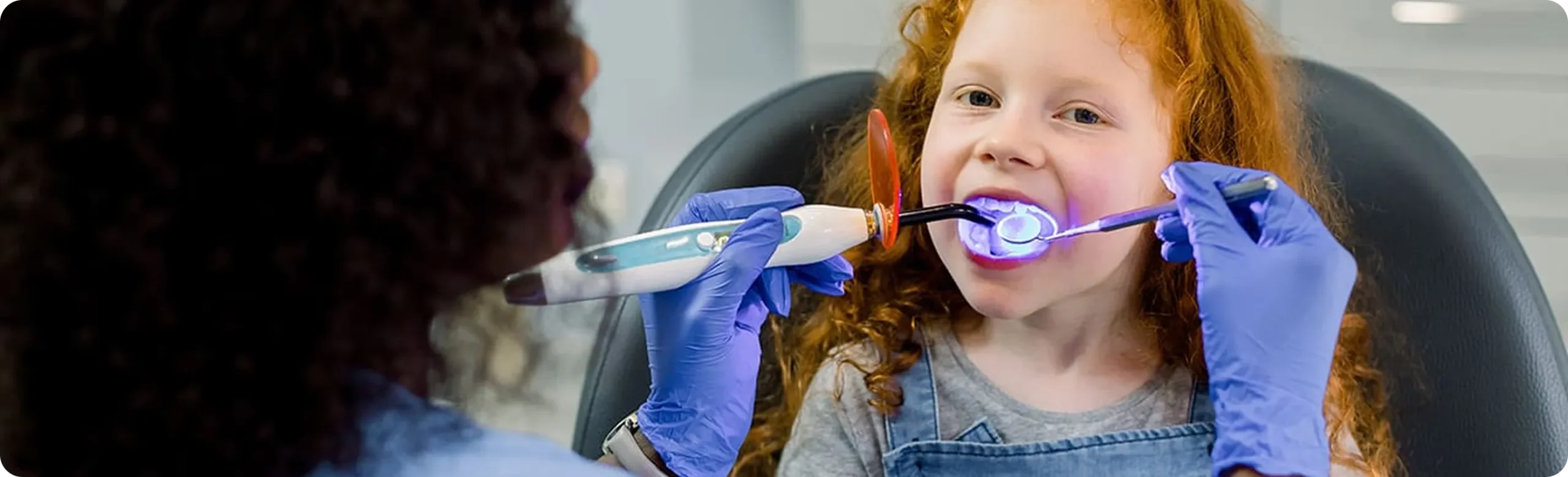 Dental Sealants for Kids in Burnaby Dental Sealants for Kids in Burnaby
