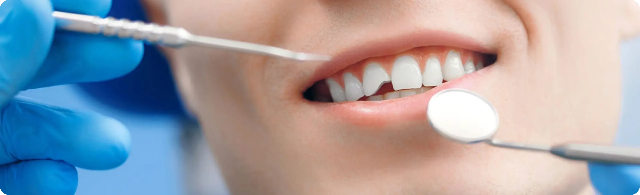 Chipped Tooth Repair (Broken Tooth Repair) Chipped Tooth Repair (Broken Tooth Repair)