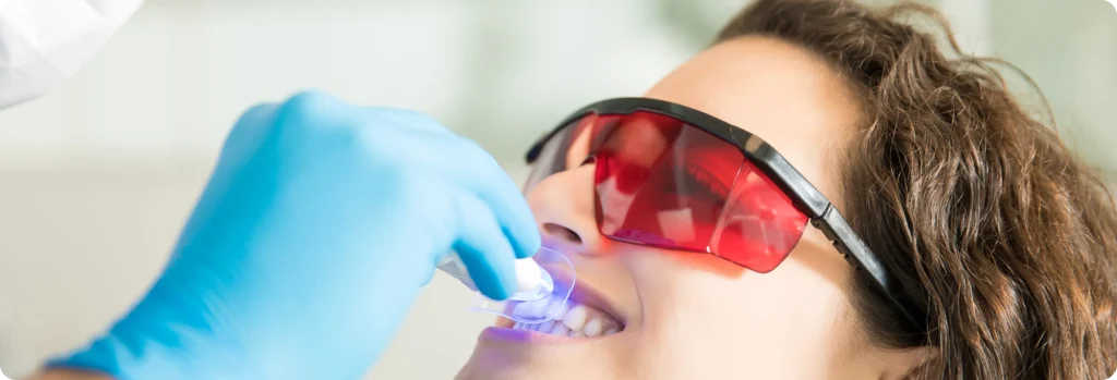 In-Office GLO Science Teeth Whitening in Burnaby