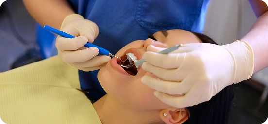 Cavity Treatment with Tooth-Coloured Fillings | Burnaby Dentist & Orthodontist