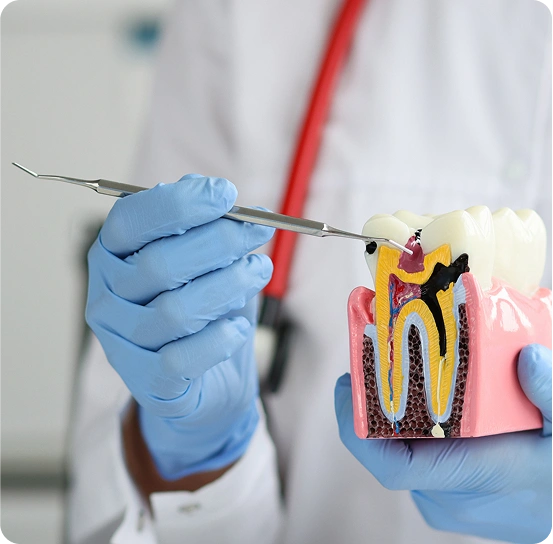 Restoring Tooth Structure with Fillings