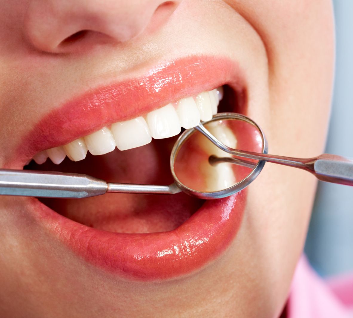 Scaling & Root Planing for Gum Health