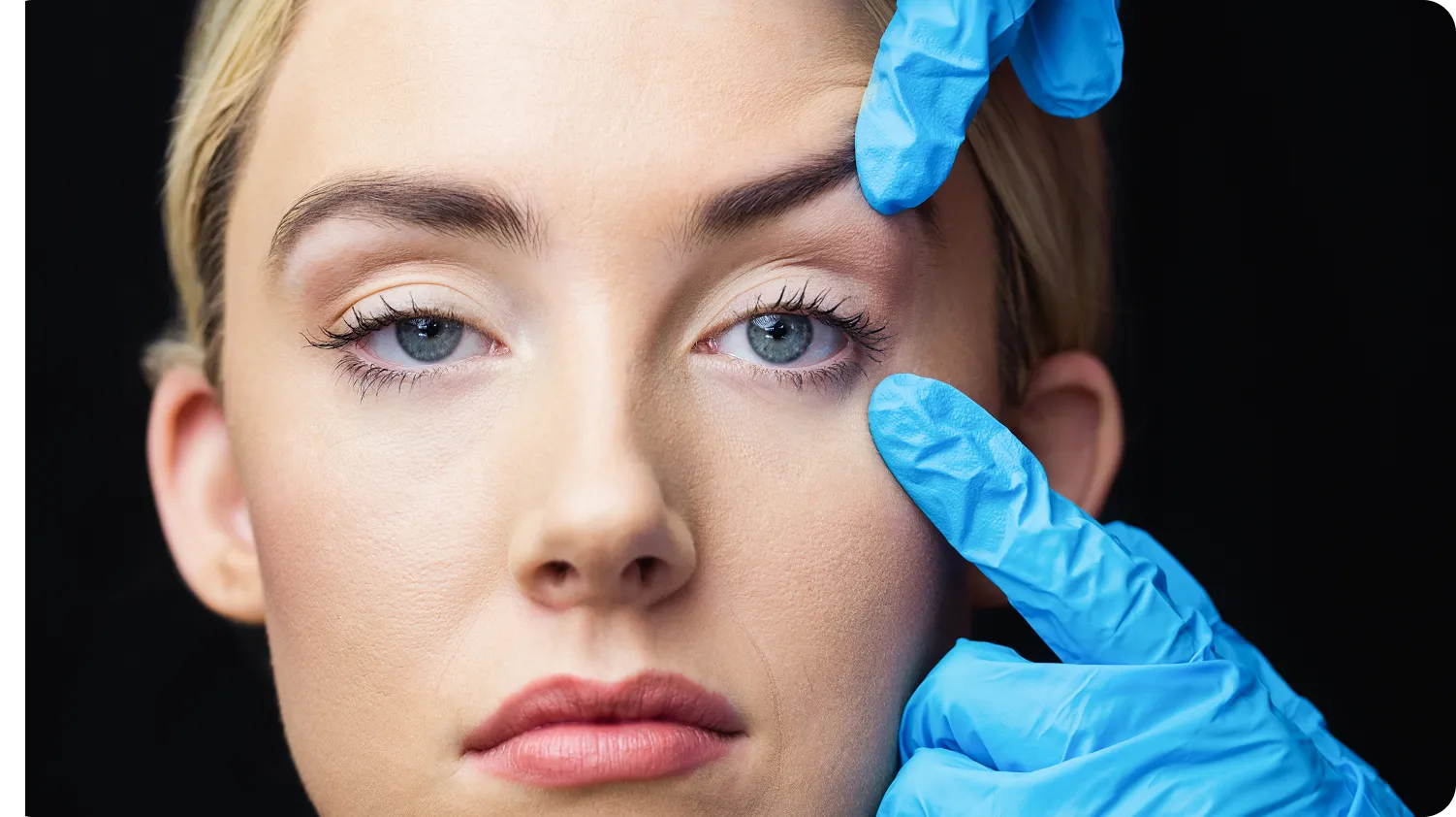 Brow Lift and Hooded Eyes