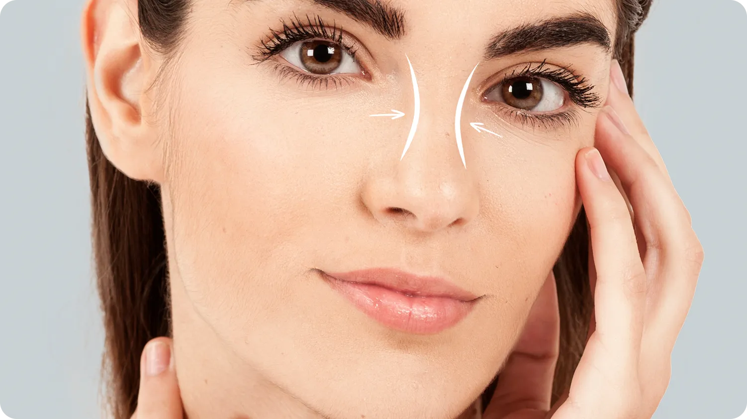 Bunny Lines (Upper Nose)