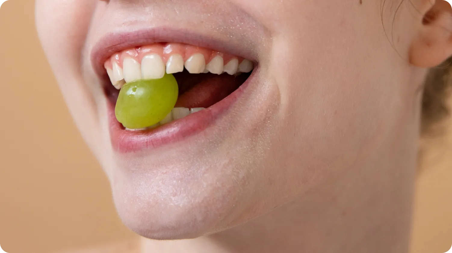 Gummy Smile Correction