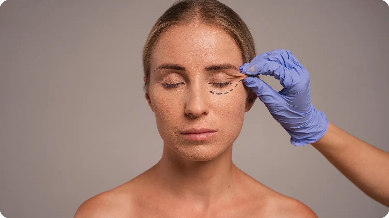 Under-Eye Area (Tear Trough Wrinkles) — Advanced Treatment