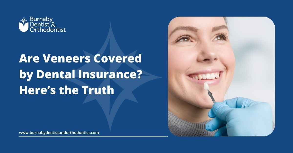 Veneers & Insurance in Canada: What’s Covered in 2025
