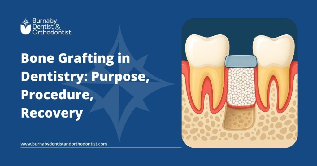 Bone Grafting in Dentistry: Purpose, Procedure, Recovery