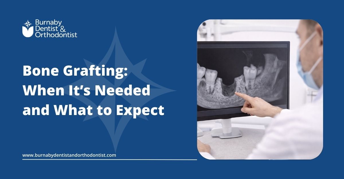 Bone grafting in dentistry used to rebuild jawbone loss