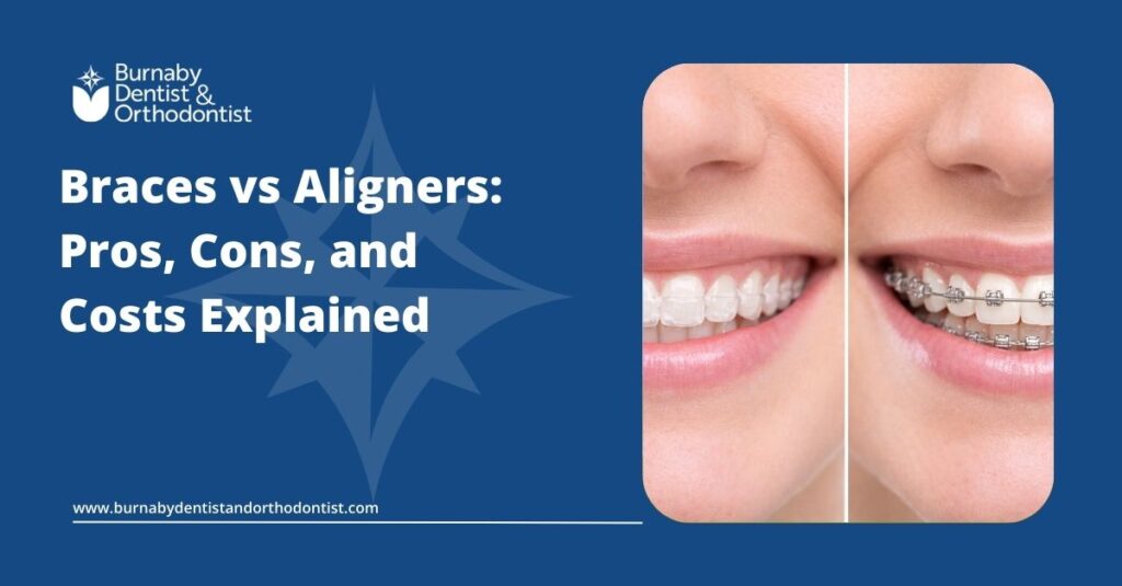 Invisalign clear aligners compared with metal braces for teeth straightening