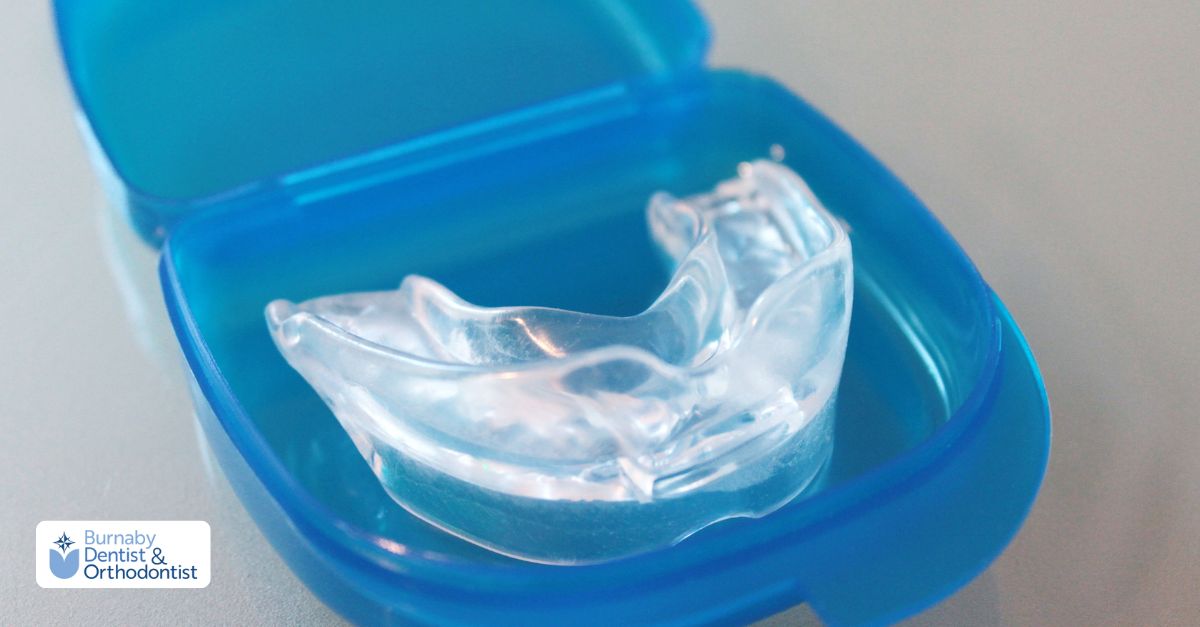 Nightguard vs. Sports Mouthguard in Burnaby: Custom Fit with Digital Scans Clear dental mouthguard stored in a protective case after cleaning.