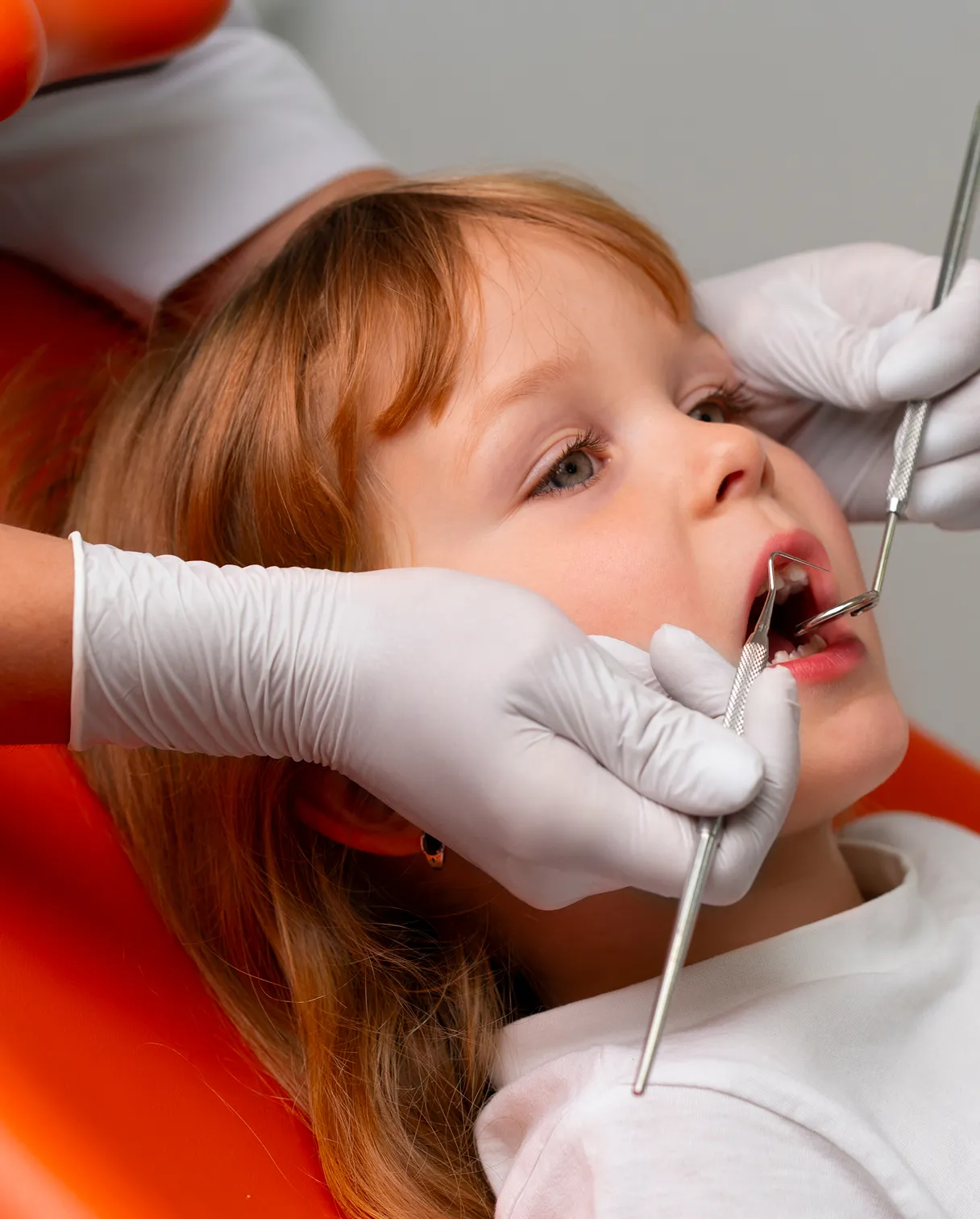 Pulpotomy vs Pulpectomy Pulpotomy vs Pulpectomy