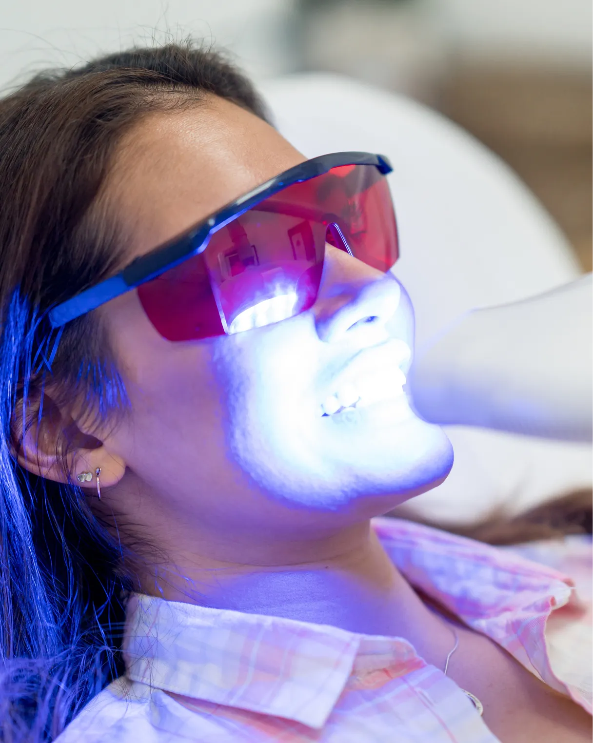 In-Office GLO Science Teeth Whitening in Burnaby