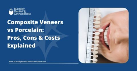 Porcelain and composite veneers comparison for cosmetic dental treatment.