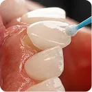 Cosmetic & Smile Design