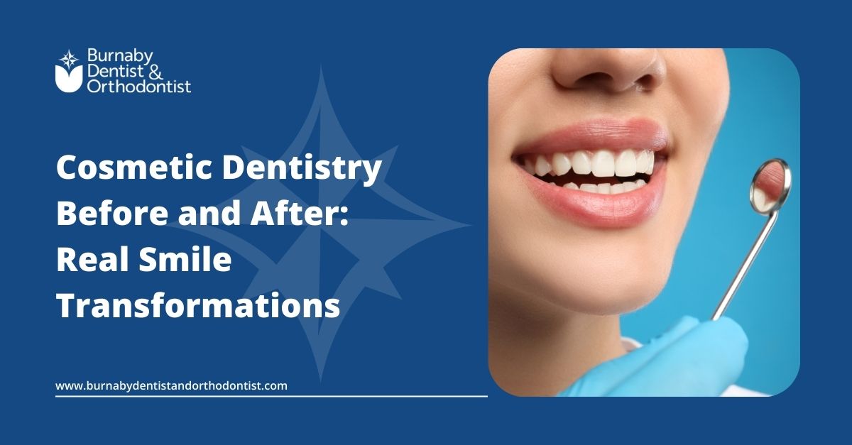 Cosmetic Dentistry Before and After: Real Smile Results