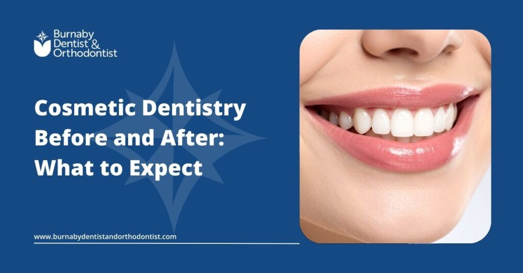 Close-up smile after cosmetic dentistry treatment, showing brighter, more even teeth and natural-looking results