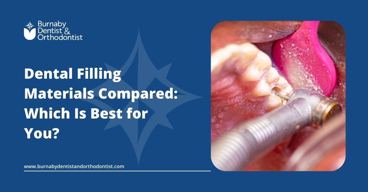Dental Filling Materials Compared: Which Is Best for You?